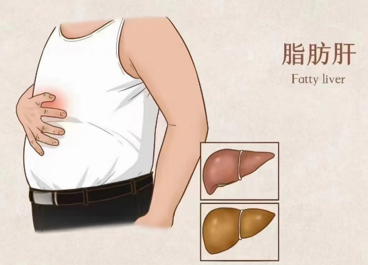 燃燒內臟脂肪抗疲勞！六種營養素趕走脂肪肝