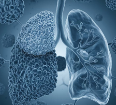 遠離肺癌，飲食除三害