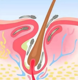 臉上蠕形螨蟲好可怕？殺蟲大作戰臉上蠕形螨蟲好可怕？殺蟲大作戰