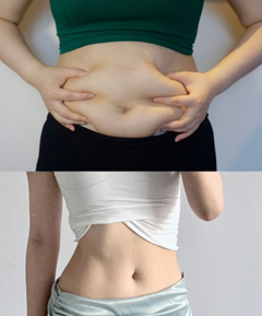 先增肌還是先減脂？營養師解析最佳策略