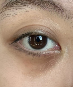 黑眼圈遮不住？從飲食根本調整