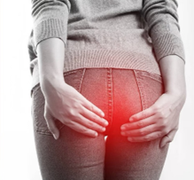 痔瘡是什麼？常見形成原因大公開