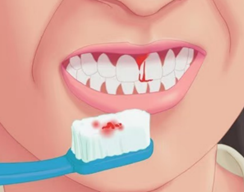 刷牙流血卻不是牙周病？小心四種血液疾病！