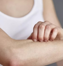 換季濕疹過敏怎麼改善？專家教你飲食與生活調理法