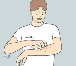 濕疹/乾癬老是癢？反覆發癢的食物注意了！