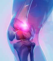 膝關節卡卡之苦　四大關鍵營養素守護行動力