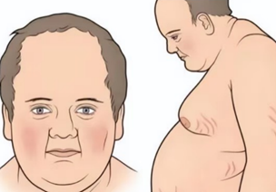 庫欣氏症候群：症狀與改善方式一次看