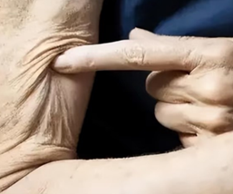 肌少症的自我檢測，提早預防很重要