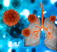 肺癌不是抽菸專屬！你以為自己沒事，其實還有其他風險