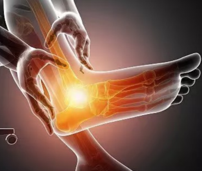 台灣高尿酸世界第一！五少二多保健法避免高尿酸