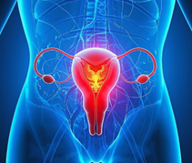 子宮內膜異位症八大症狀！提早發現保護生育力