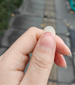 指甲一直斷？營養這樣吃，讓指甲更強韌！