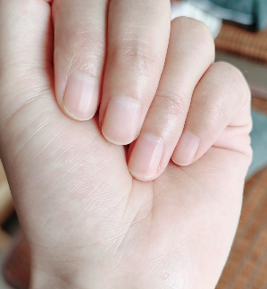 指甲一直斷？可能是身體在「求救」！營養這樣補最關鍵