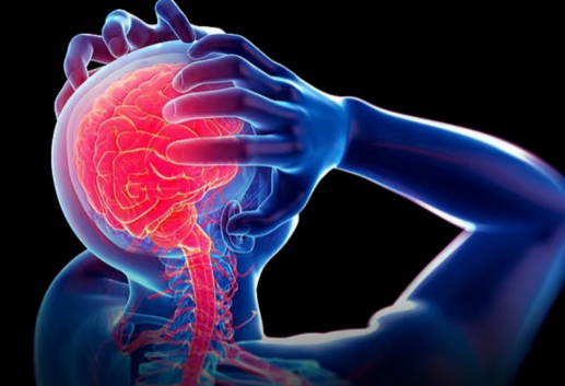 頭痛起來要人命！六招自我保健遠離頭痛生活