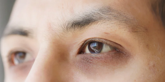 妳有黑眼圈/眼袋嗎？醫美專家揭露：8大食物＋7個習慣擺脫疲憊老態！