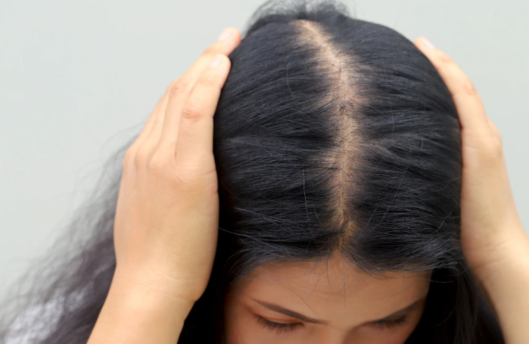 產後不崩潰！消水腫與救掉髮的「醫學級」攻略